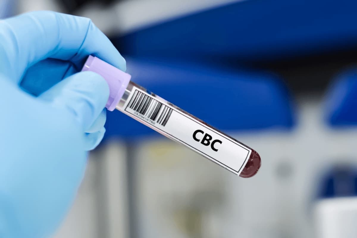 What Is a CBC Blood Test and Why Do Doctors Order It — Siza Health Care blog article